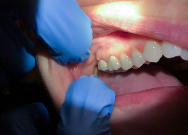 Best Broken Tooth Emergency  in El Dorado, KS
